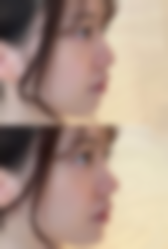 如何快速告别眼袋和黑眼圈？基础护理与美学提示