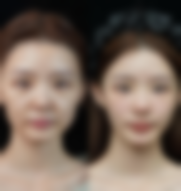 六、青岛博美医疗美容诊所价格表：（仅供参考）