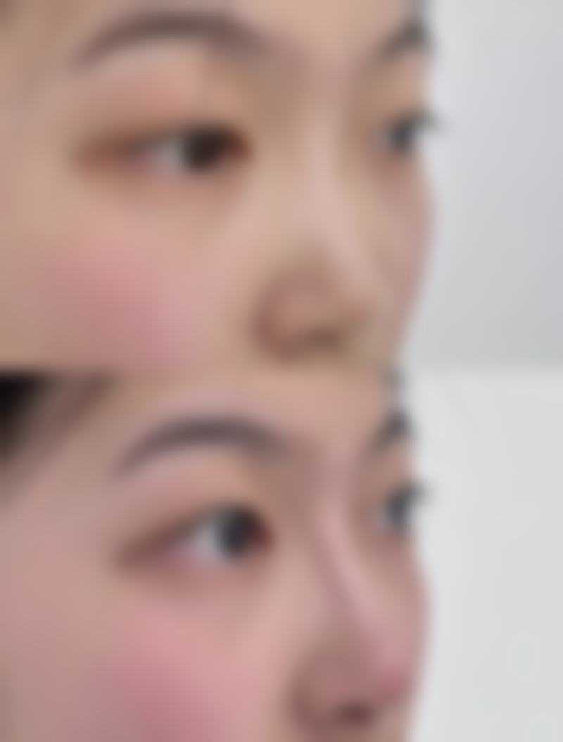 正规医院的优势：专精保护成效