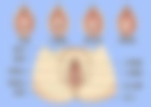 哪种双眼皮手术最适合你？结合眼部条件与审美需求，解锁专属美眼方案 