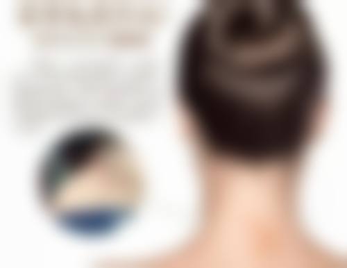 五、武汉微幕整形医院实例