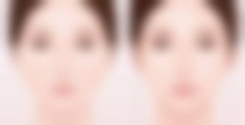 四、武汉美都医疗整形医院实例