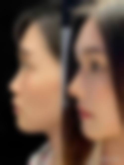 杨志超项目价格表参考