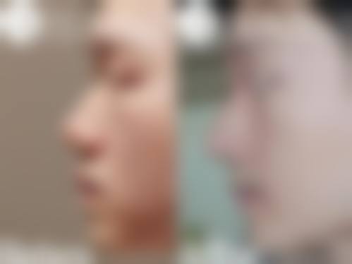 周冉怎么预约？