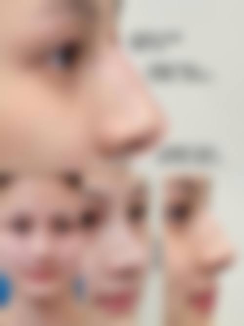 周冉项目价格表参考