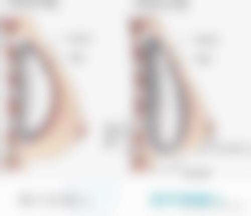 曹志明激光祛斑水平怎么样可靠吗？