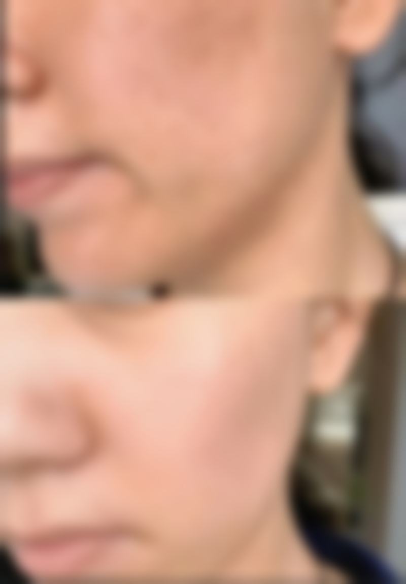 二、南宁红十字会医院医疗整形美容科正规吗？来看看医院资质：