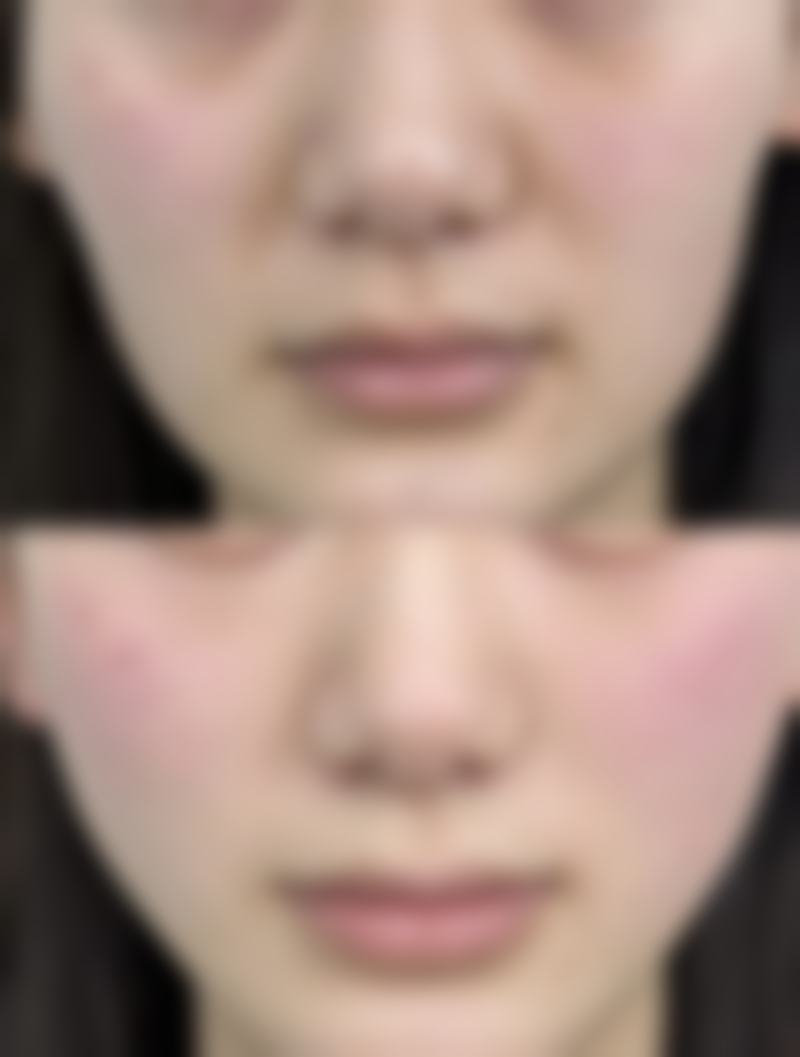 三、武汉微幕整形医院医生介绍: