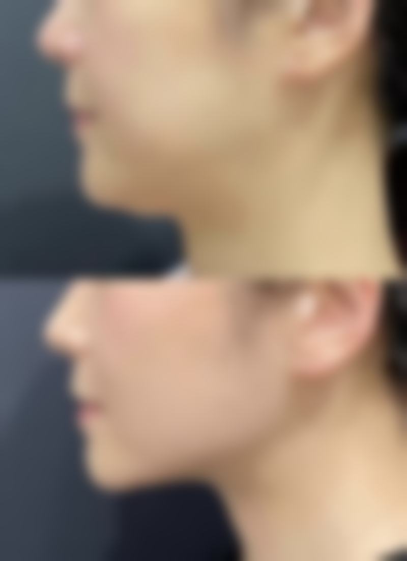 六、杭州千岛湖億美医院怎么预约：