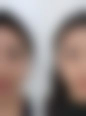 七、深圳华医医疗美容门诊部价格表：（仅供参考）