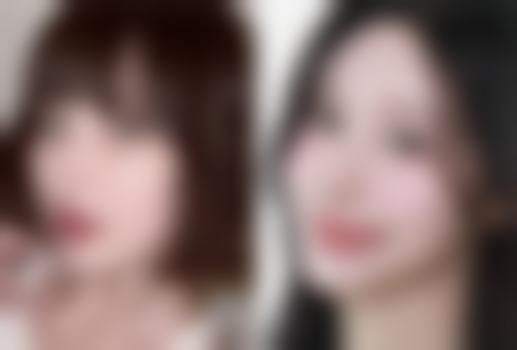 李晋才眼部整形水平怎么样可靠吗？