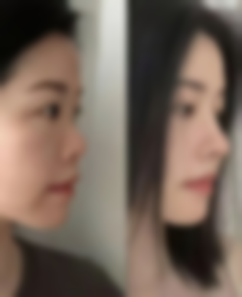 运动与修复时间的关系，照着时间表来更安心