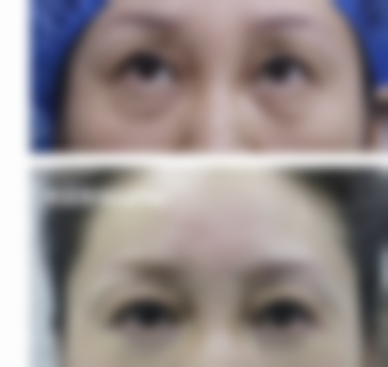 四、上海乐天美容整形外科医院实例