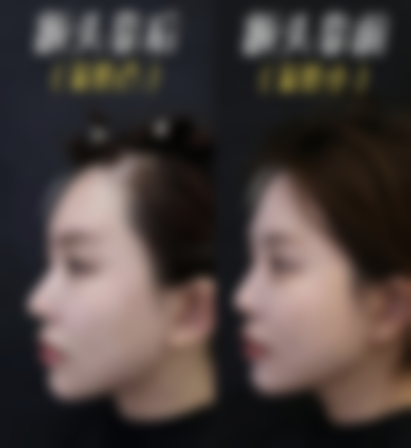 五、普洱博美整形医院怎么预约：