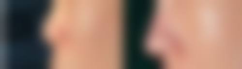 七、北京韩誉国都医疗美容诊所真实的顾客评价如下：