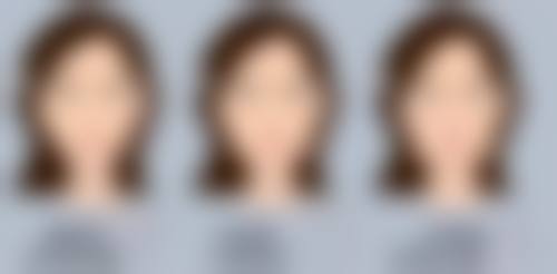 四、玉溪市人民医院(口腔颌面整形外科)实例