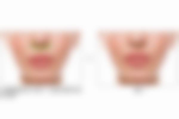 七、北京蕾士悦容门诊部热玛吉的安心性