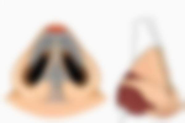 六、北京蕾士悦容门诊部热玛吉的适应人群