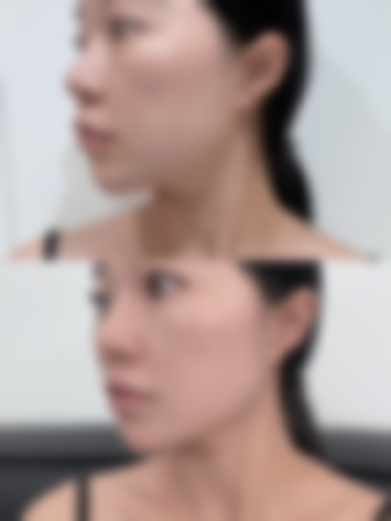 六、石家庄万瑞医疗美容门诊部怎么预约：