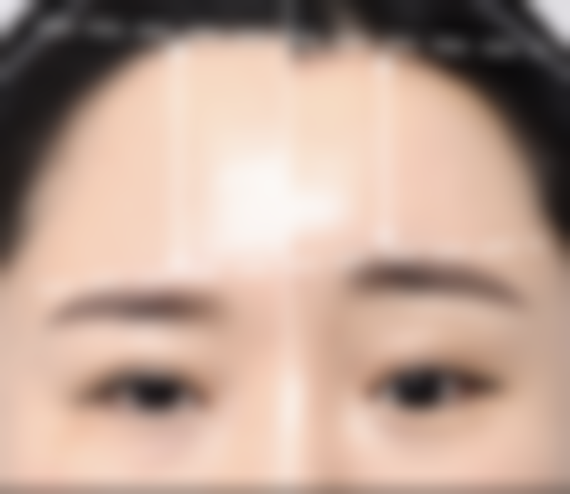 四、深圳华美医疗美容医院实例