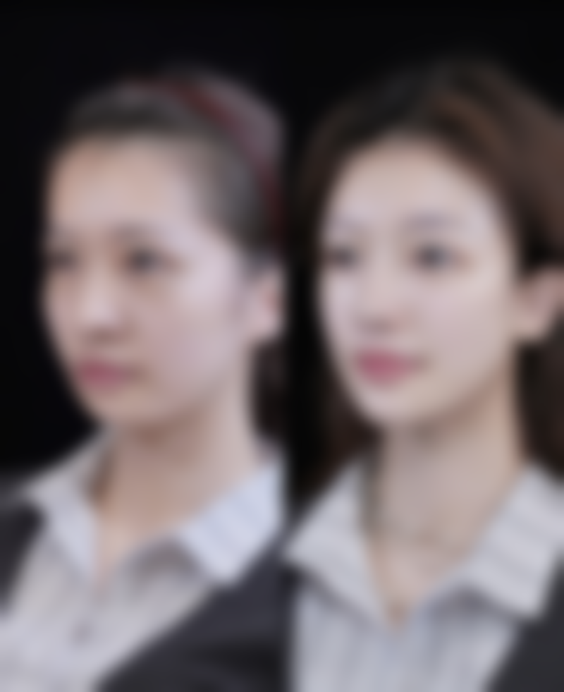 四、郑州兰茜整形医疗美容诊所实例