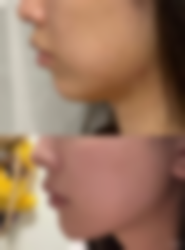 张为宝怎么预约？