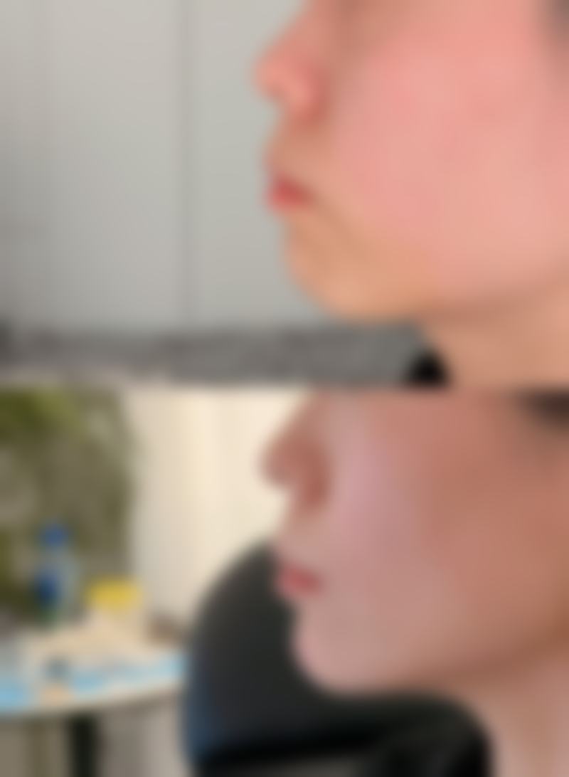 五、深圳华美医疗美容医院怎么预约：