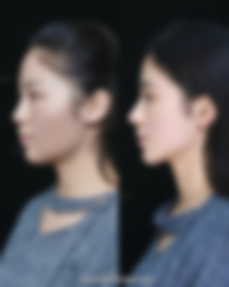 四、沈阳和平美丽会整形医疗美容门诊部实例