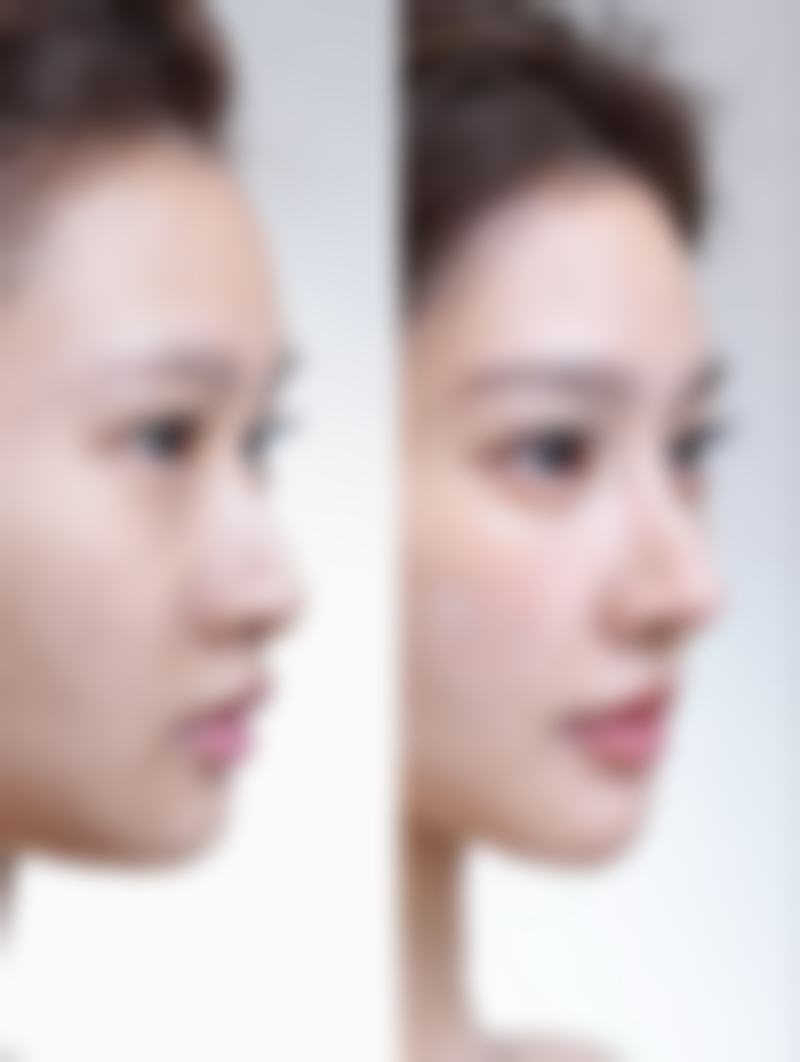 早期干预，给小孩疤痕修复开个好头