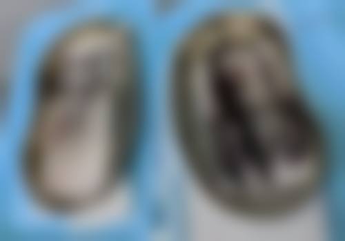 七、泉州六佰户整形医院价格表：（仅供参考）