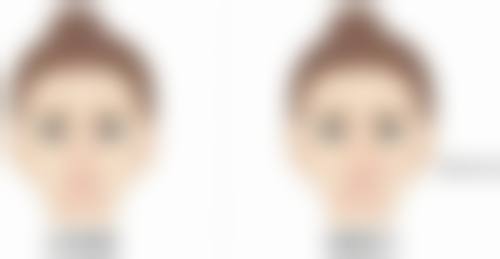 五、包头市熙妍医疗美容怎么预约：