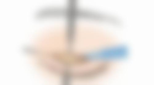 五、韩国shine beam皮肤科 大田店怎么预约：