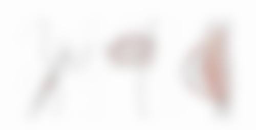 调整心理预期，坦然面对手术