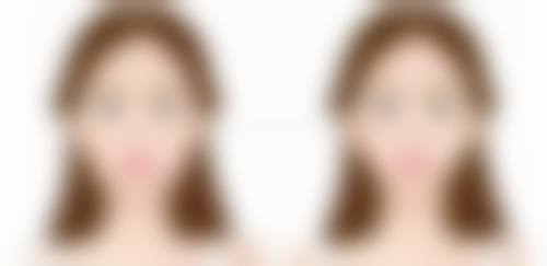 郑志雄口腔美容项目价格表参考