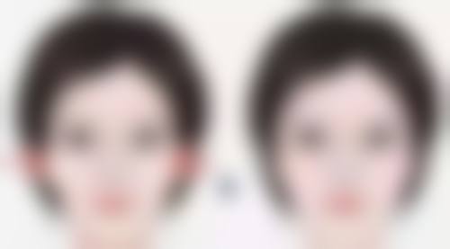 专精医院选择攻略之医生和技术实力