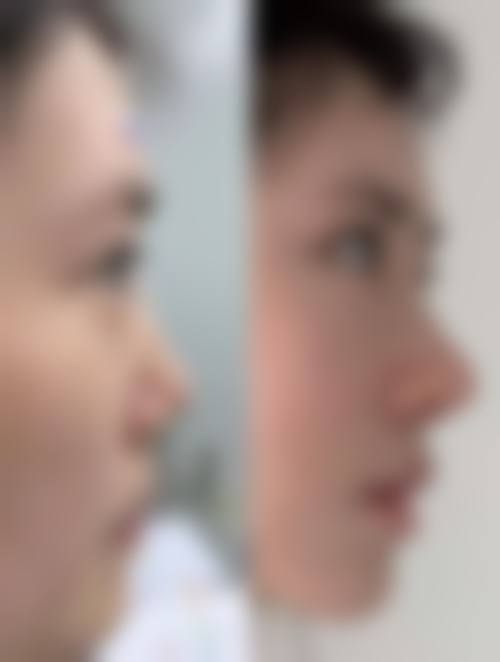 罗南生口碑和评价