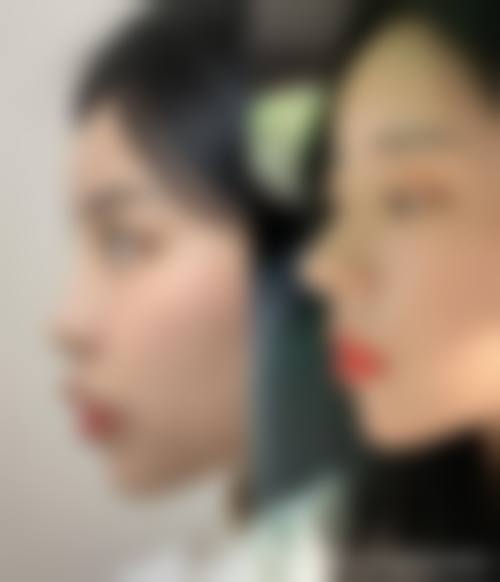 罗南生项目价格表参考