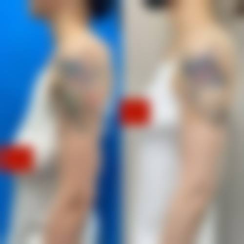 罗南生眼鼻整形实例