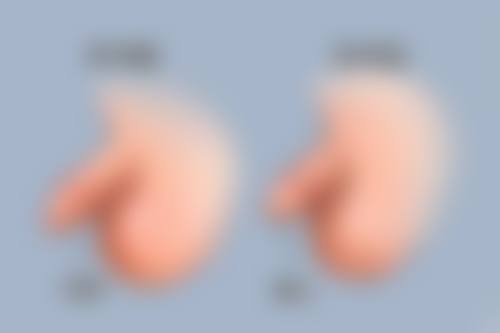 马严在哪家医院