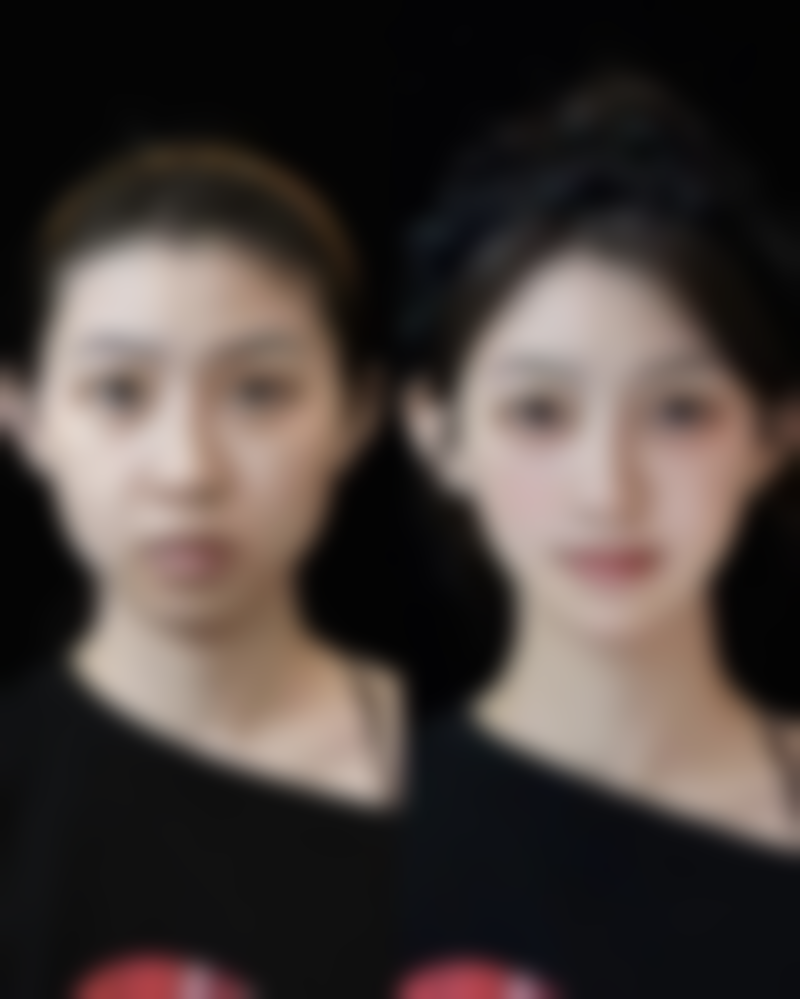 七、厦门左语整形医院真实的顾客评价如下：