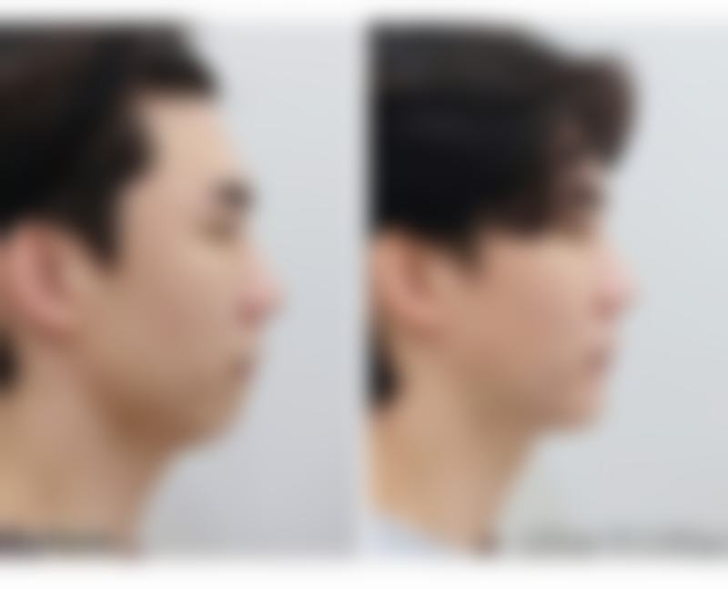 八、泉州六佰户整形医院真实的顾客评价如下：