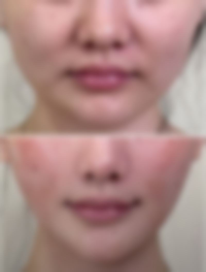 七、韩国DIVA整形外科皮肤科医院真实的顾客评价如下：