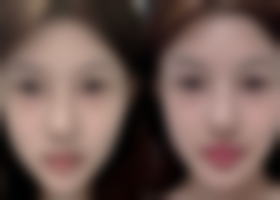 六、枣阳美度非凡医疗美容医院价格表：（仅供参考）