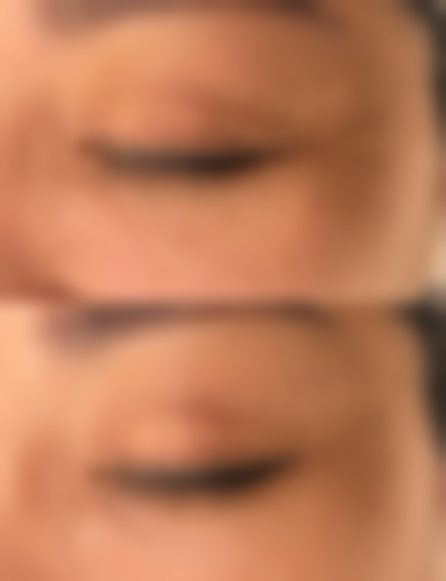 合肥艺星整形医院怎么样？正规靠谱手术签约保障求美者权益