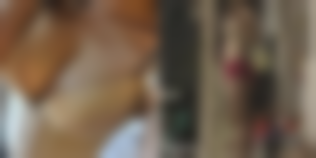 张春彦自体脂肪面部填充实例