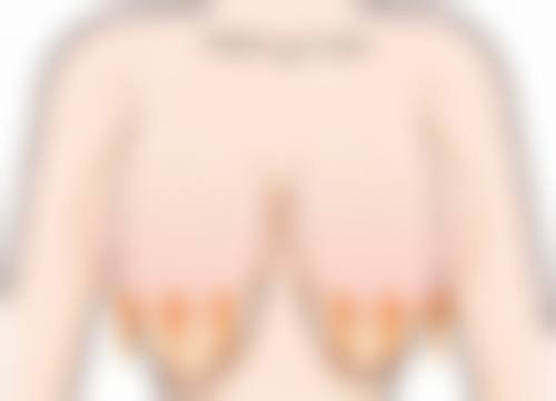 拉双眼皮修复：出现异常别慌张