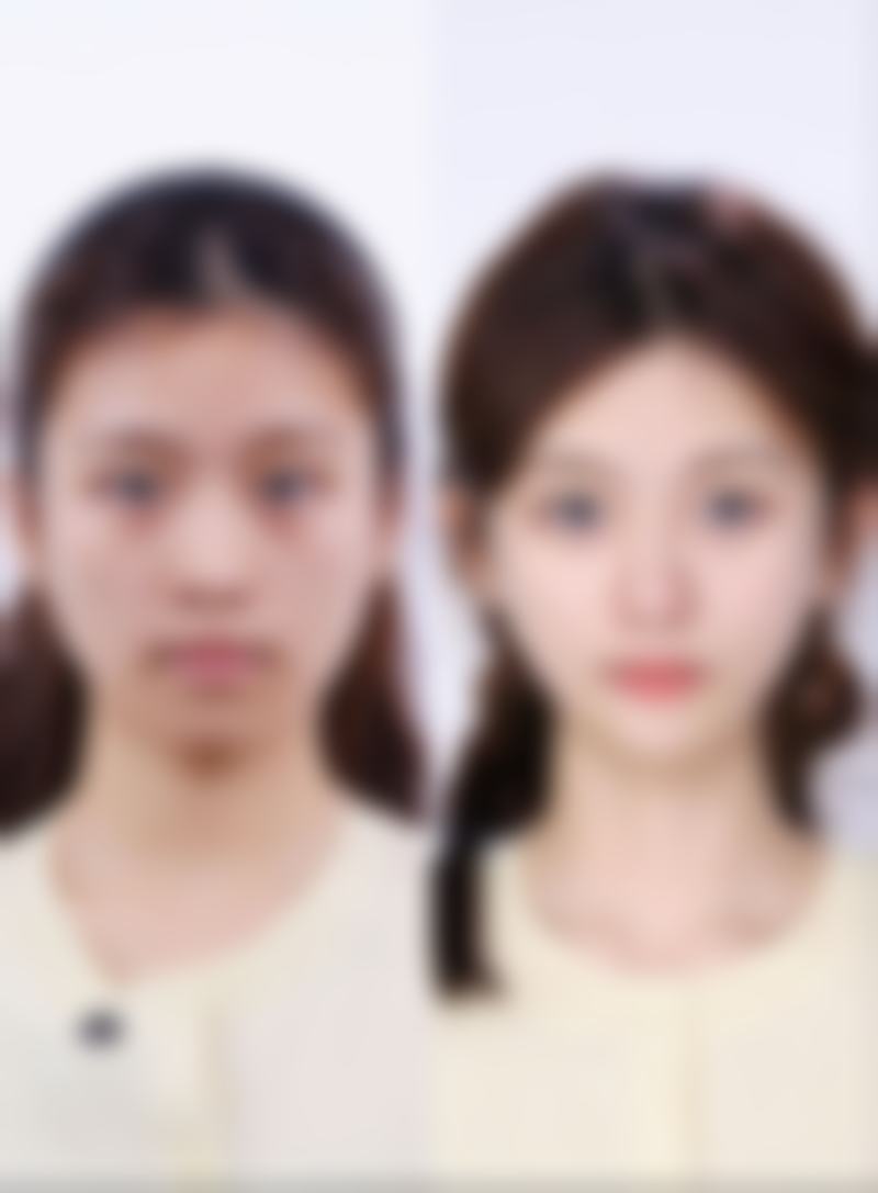 五、镜湖区华美医疗美容诊所实例