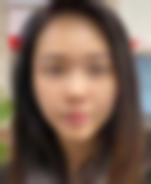 给想做面部提拉的姐妹的真心话