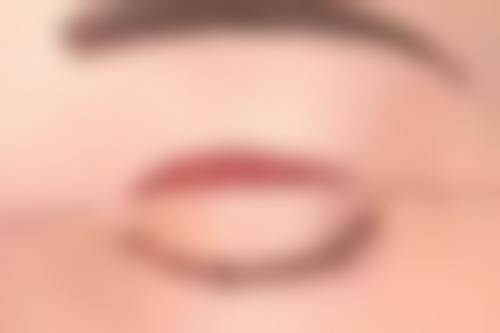 四、厦门中医院整形科实例