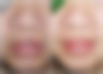 七、湖北省妇幼保健院(医疗美容科)真实的顾客评价如下：